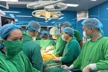 Врачи проводят трансплантацию лёгких. Фото: ВИА